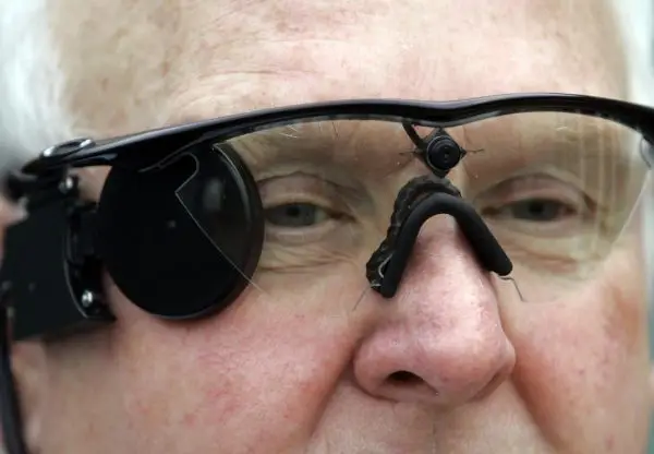 Don't Look Now, First Bionic Eye Exists 2 Argus II