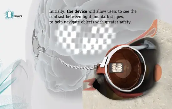 Australian scientists implant bionic eye, cyborg revolt forthcoming 2 australian bionic eye 1