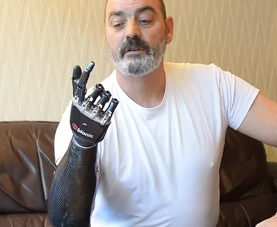 Bebionic preps the world's most advanced bionic hand, Star Wars fans rejoice 2 bebionic bionic arm 1