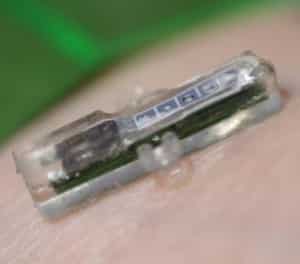 This Implant Lets Your Smartphone Monitor Your Blood 3 implant-sensor-2
