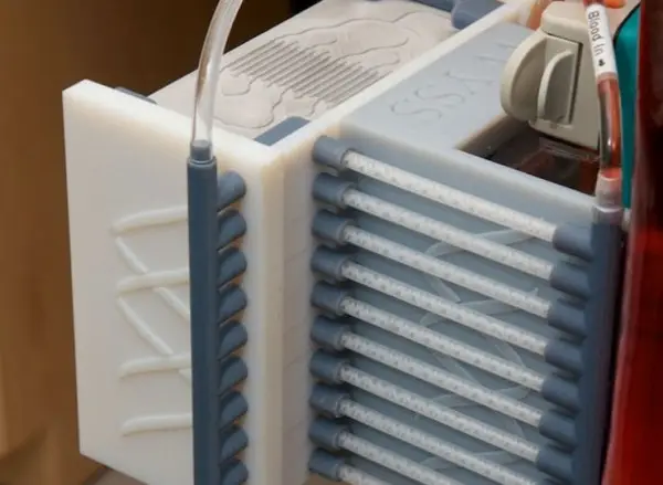 This Contraption Attaches to You and Acts as a Second Spleen 2 spleen-on-chip