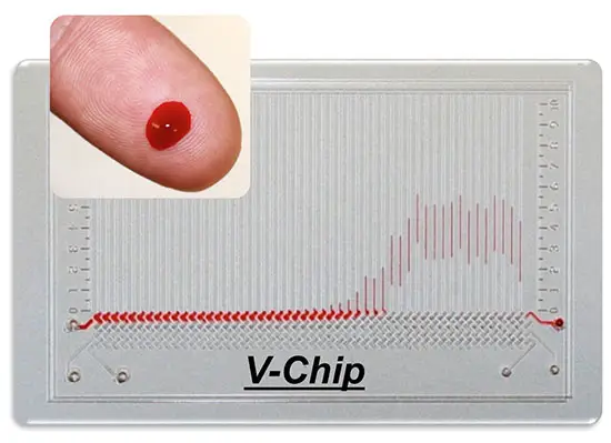 V-Chip is a pocket-sized gadget that runs over 50 blood tests 2 v-chip-1