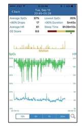 BodiMetrics O2 Vibe Sleep & Fitness Monitor