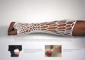 Introducing Cortex - A Breathable, Recyclable 3D-Printed Arm Cast 18
