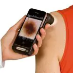 Handyscope Scanner that Checks For Skin Cancer 12
