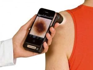 Handyscope Scanner that Checks For Skin Cancer 1