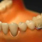 This Wi-Fi Tooth Sensor Shames You When Overeating or Smoking 21