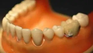 This Wi-Fi Tooth Sensor Shames You When Overeating or Smoking 16