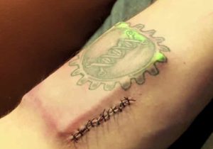 Here's a Guy Who Stitched a Computer Into His Arm 4