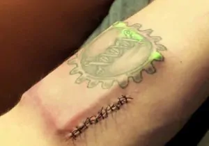 Here's a Guy Who Stitched a Computer Into His Arm 10