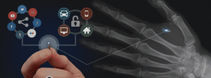 The xNT Implant is Creepy but Cool NFC Technology 1