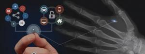 The xNT Implant is Creepy but Cool NFC Technology 10