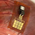 This Device Uses Heartbeats to Charge a Pacemaker 23 This Device Uses Heartbeats to Charge a Pacemaker 22