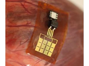 This Device Uses Heartbeats to Charge a Pacemaker 2