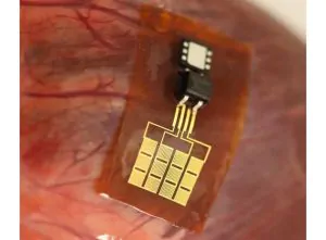 This Device Uses Heartbeats to Charge a Pacemaker 13