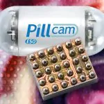 These Pills Are Actually Little Cameras That You Swallow 26 These Pills Are Actually Little Cameras That You Swallow 25