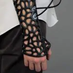 These 3D-Printed Casts Use Ultrasound to Heal Your Body Fast 4