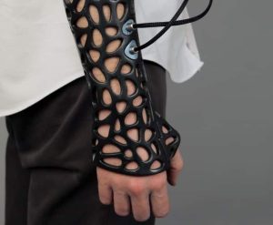 These 3D-Printed Casts Use Ultrasound to Heal Your Body Fast 1