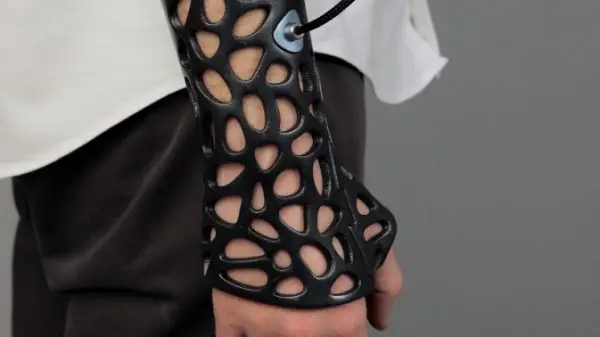 These 3D-Printed Casts Use Ultrasound to Heal Your Body Fast 2