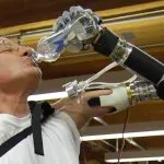 Segway Inventor Creates Innovative Prosthetic Arm 7