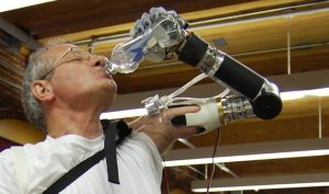 Segway Inventor Creates Innovative Prosthetic Arm 3