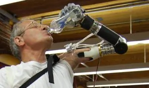 Segway Inventor Creates Innovative Prosthetic Arm 21 Segway Inventor Creates Innovative Prosthetic Arm 11