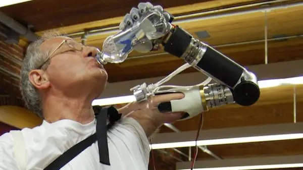 Segway Inventor Creates Innovative Prosthetic Arm 1