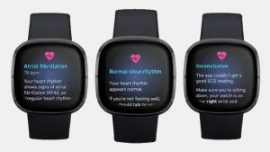 Why ?Fitbit Sense ECG is your essential health tool for2021 15