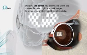 Australian scientists implant bionic eye, cyborg revolt forthcoming 2