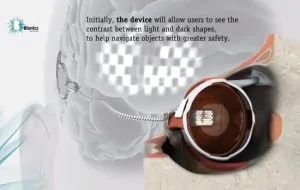 Australian scientists implant bionic eye, cyborg revolt forthcoming 1 Australian scientists implant bionic eye, cyborg revolt forthcoming 1