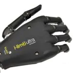 Touch Bionics Prosthetic Hand 1