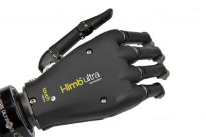 Touch Bionics Prosthetic Hand 1