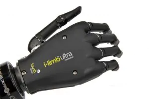 Touch Bionics Prosthetic Hand 13