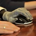 Touch Bionics Prosthetic Hand 4