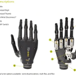 Touch Bionics Prosthetic Hand 2