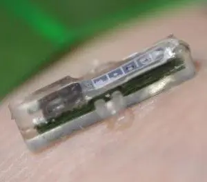 This Implant Lets Your Smartphone Monitor Your Blood 1 This Implant Lets Your Smartphone Monitor Your Blood 1