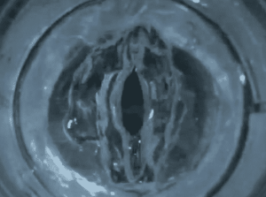 Synthetic vocal cord gel could give people their voices back 7