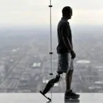 Man gets fitted with bionic leg powered by human thought 5 Man gets fitted with bionic leg powered by human thought 4